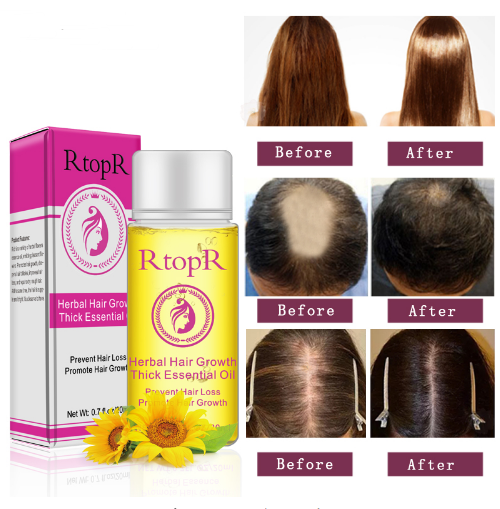 Fast Powerful Hair Growth Products Essential Oil Liquid Treatment Preventing Hair Loss