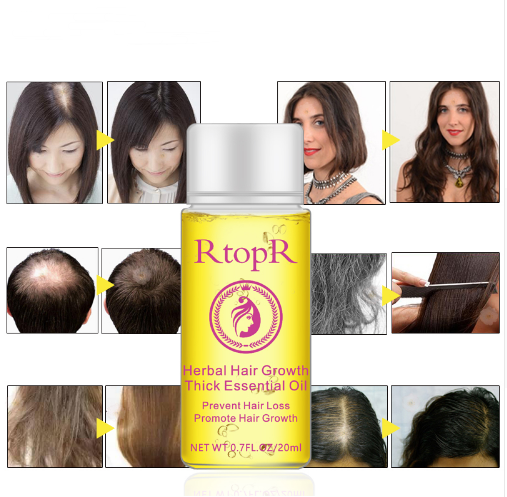 Fast Powerful Hair Growth Products Essential Oil Liquid Treatment Preventing Hair Loss