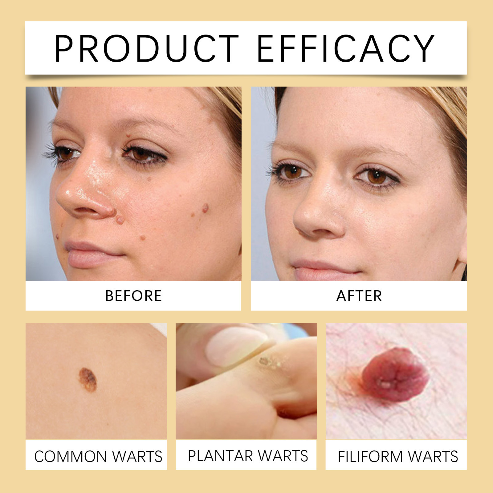 Gentle Cleansing Smooth Body Skin Moisturizing Skin Mole Bee