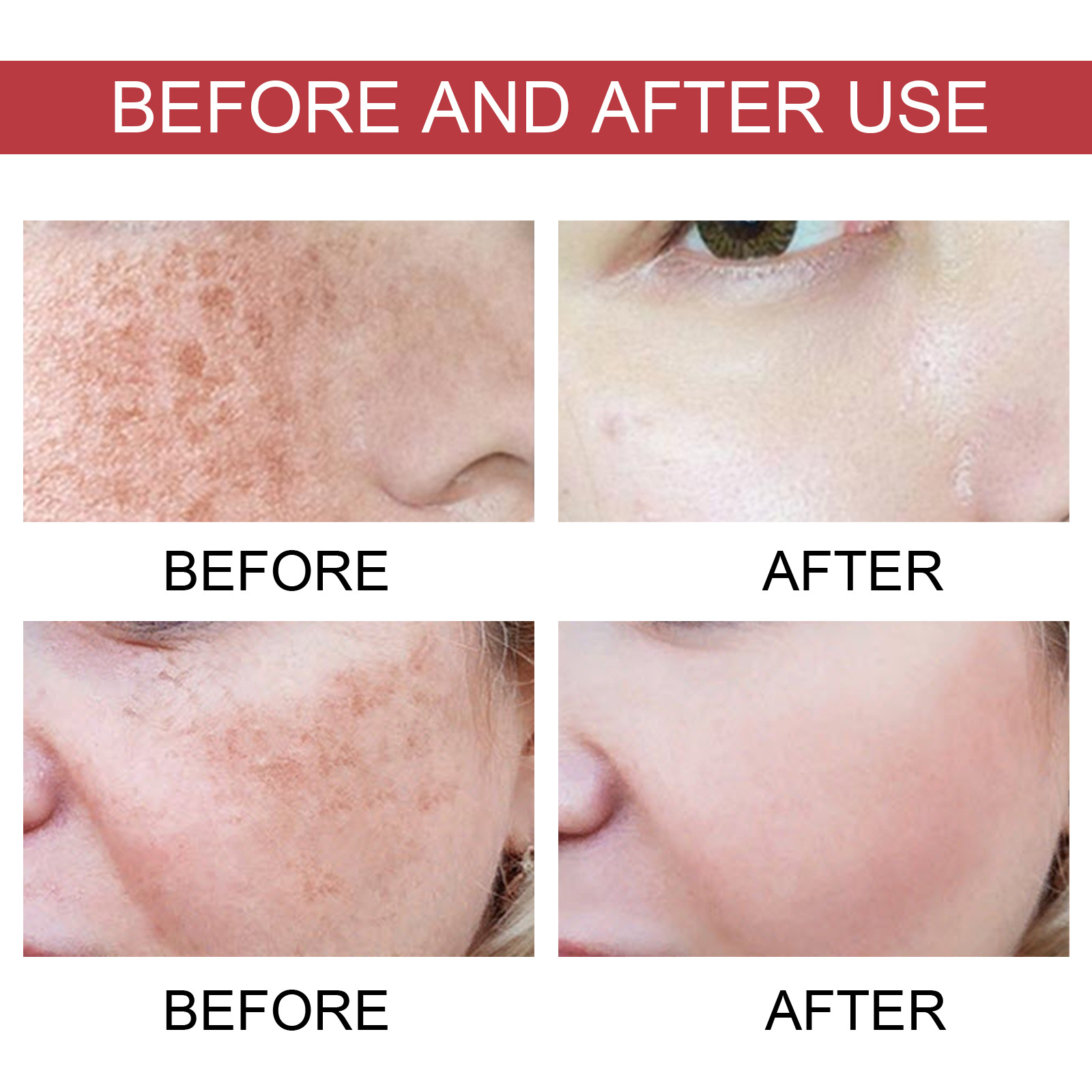 Hoygi Black Spot Repair Essence Lighten Skin Black Spot And Age Spot