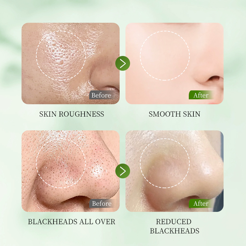 HUNMUI Whitening Exfoliating Gel 50g