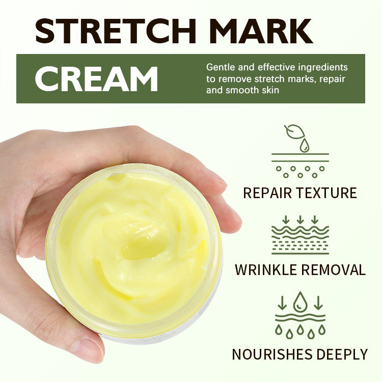 Stretch Mark Cream Fat Body Pattern Recovery Cream