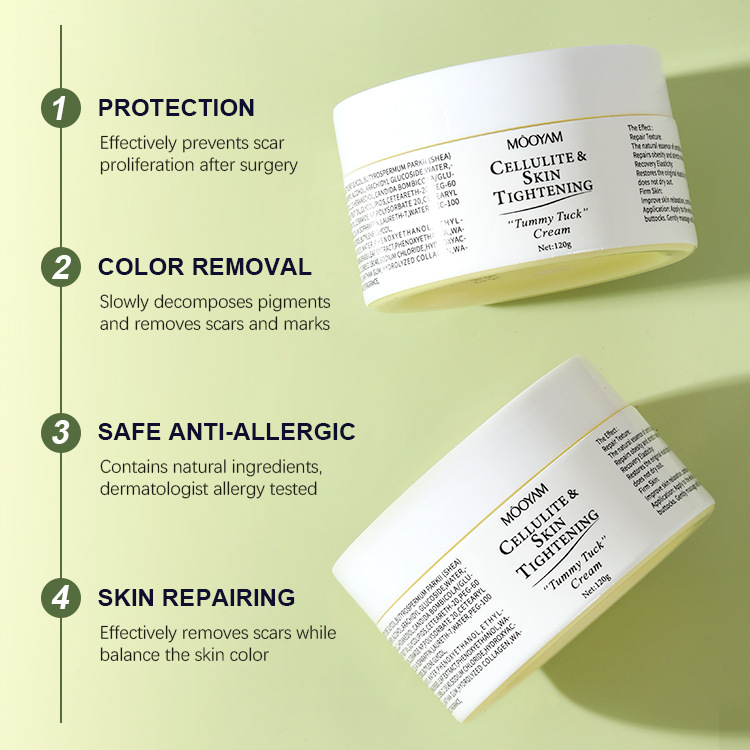 Stretch Mark Cream Fat Body Pattern Recovery Cream