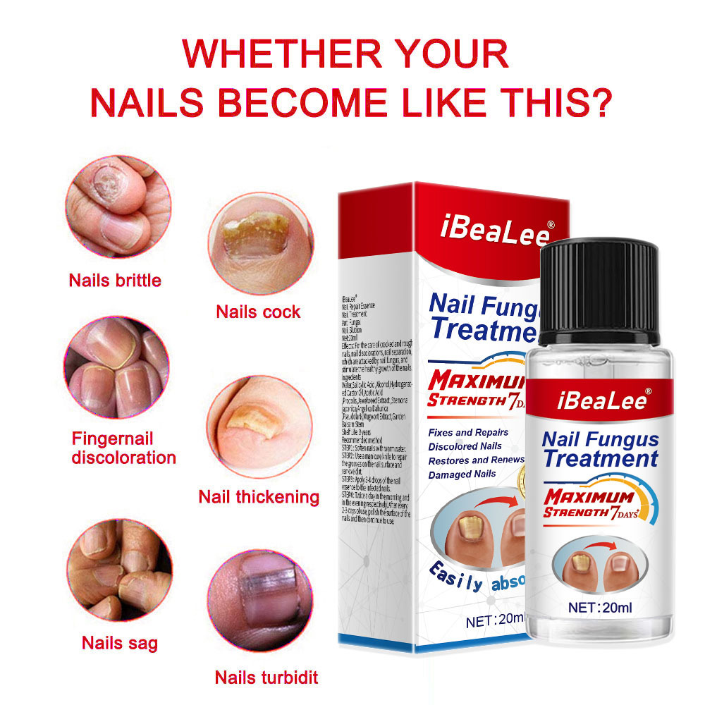 Thickening Of Special Bacteriostatic Liquid For Onychomycosis
